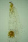 Acrocercops brongniardella