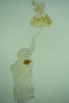 Depressaria albipunctella