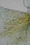 Aethes cnicana/rubigana