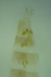 Stenoptilia