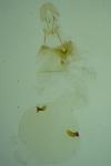 Epinotia tedella