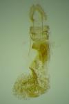 Eupoecilia angustana