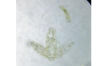 Agonopterix scopariella