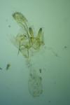 Paraswammerdamia albicapitella