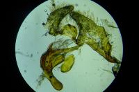 Aethes hartmanniana