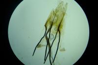Coleophora albicosta