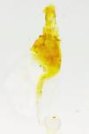 Phyllonorycter quercifoliella