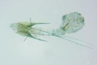 Scrobipalpa atriplicella