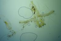 Neofaculta ericetella