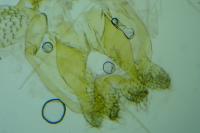 Neofaculta ericetella