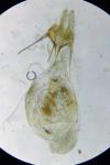 Aethes cnicana