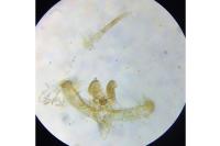 Elachista atricomella