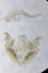 Stenoptilia zophodactyla