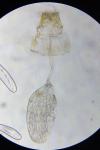 Parornix betulae