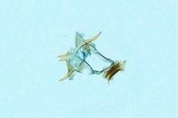 Epinotia immundana