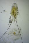 Teleiopsis diffinis