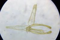 Phyllonorycter blancardella