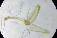 Phyllonorycter blancardella