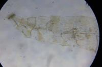 Phyllonorycter geniculella