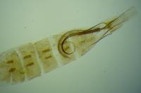 Coleophora brunneosignata