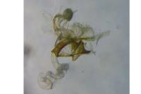 Coleophora serratella