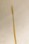 Rhigognostis annulatella