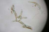 Oxyptilus ericetorum