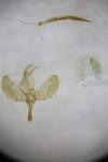 Yponomeuta irrorella