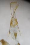 Scythris clavella
