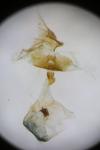 Eucosma conterminana