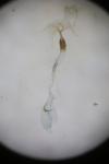 Coleophora albicostella