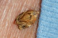 Ditula angustiorana