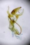 Aproaerema anthyllidella