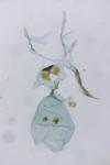Pammene juniperana