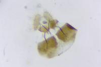 Pammene juniperana