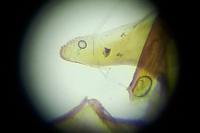 Dichrorampha sedatana