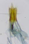 Coleophora taeniipennella