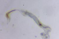Coleophora texanella