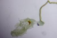 Blastobasis glandulella