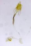 Coleophora glaucicolella