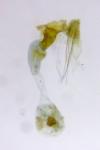 Crassa tinctella