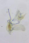 Coptotriche angusticollella