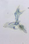 Coptotriche angusticollella