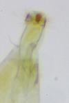 Phyllonorycter trifasciella