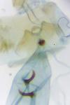 Grapholita funebrana