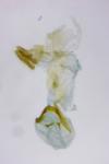 Rhopobota naevana