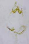 Coleophora versurella