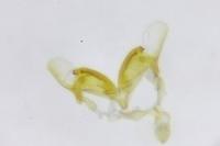 Coleophora versurella