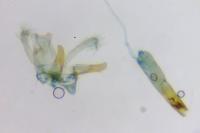 Blastodacna atra