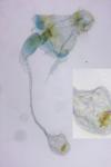 Depressaria ultimella
